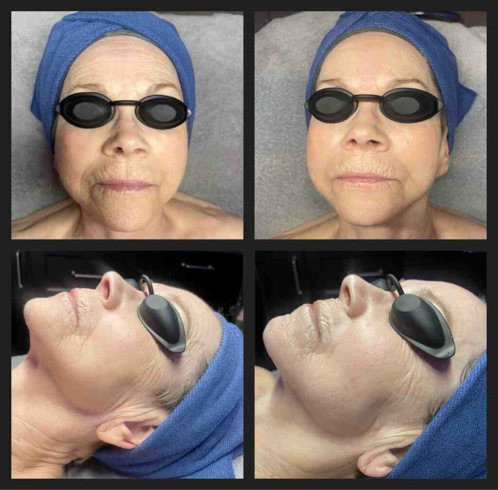 Before and Afters with Maria Keller