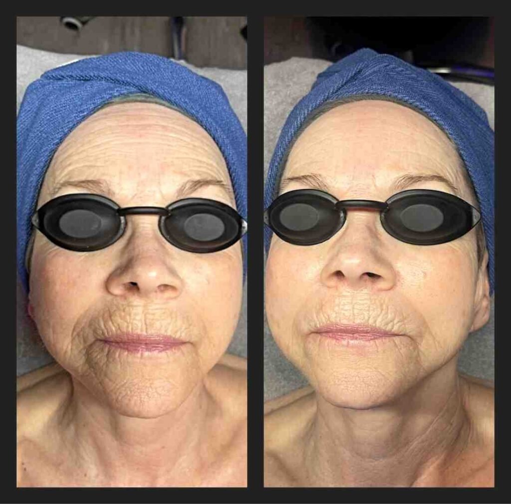 Before and Afters with Maria Keller